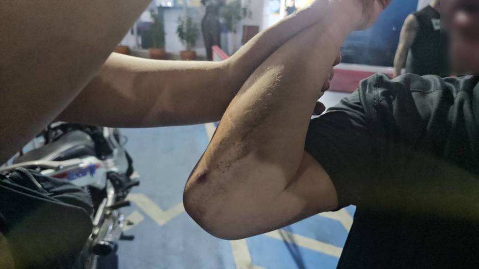 Am Arm des Betroffenen sind nach dem Vorfall sichtbare Verletzungen und Schürfwunden zu erkennen. Bild: TMN.TV
